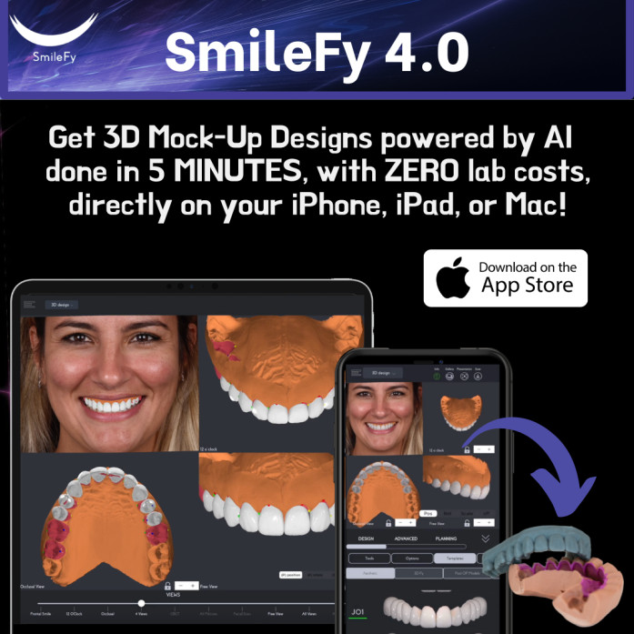 Smilefy 4.0 - Automated 3D Smile Design Powered by AI